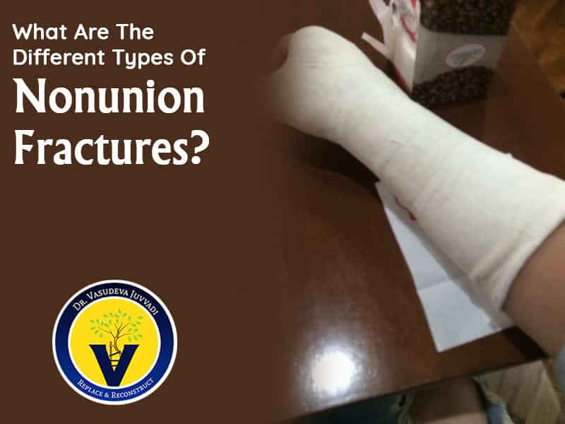 Contact today with Dr Vasu Juvvadi at Best Hospital for Nonunion Fracture Treatment in Hyderabad