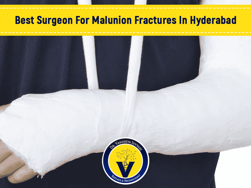 Consult Now Dr Vasudeva Juvvadi, Best Orthopedic Surgeon For Malunion Fractures In Hyderabad