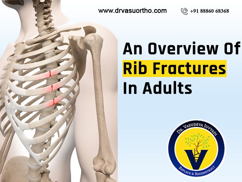 Rib fracture treatment