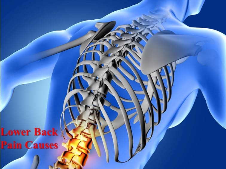 Lower back pain causes