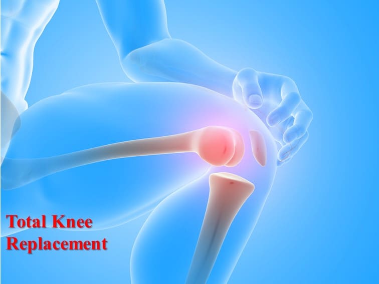 knee replacement surgery in Hyderabad