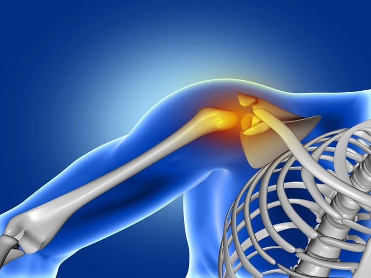 Shoulder pain causes